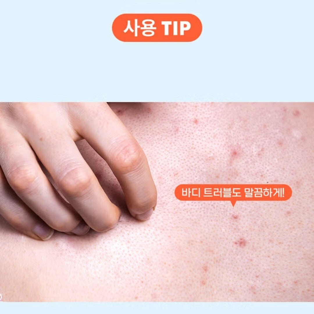 1+1/a. Solution Heartleaf+BHA Cleansing Foam 10oz.Acne/Sebum/Blackhead/Sensitive