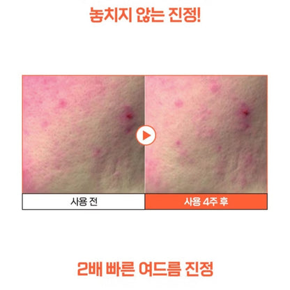 a.solution Heartleaf+Calamine Calming Cream 1.69 oz.+Cleansing Foam 5 oz./Acne