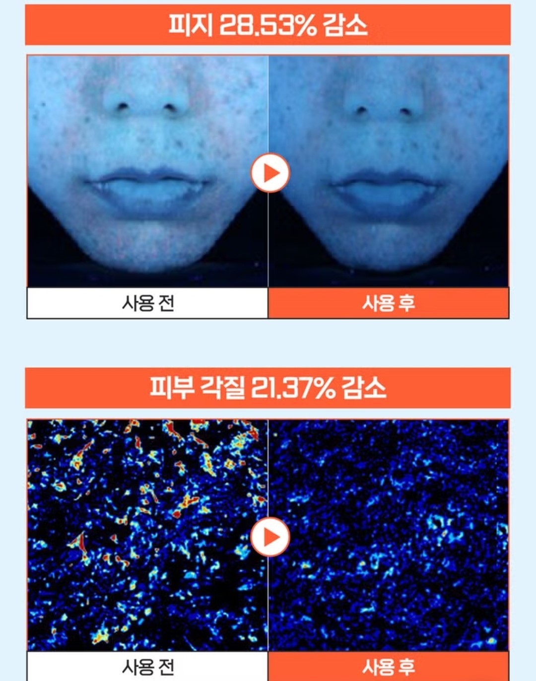 a.solution Heartleaf+Calamine Calming Cream 1.69 oz.+Cleansing Foam 5 oz./Acne