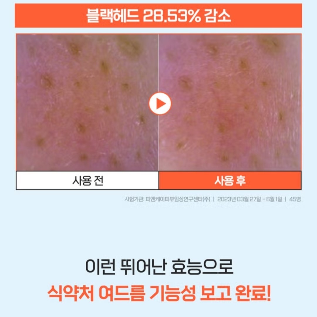 a.solution Heartleaf+Calamine Calming Cream 1.69 oz.+Cleansing Foam 5 oz./Acne