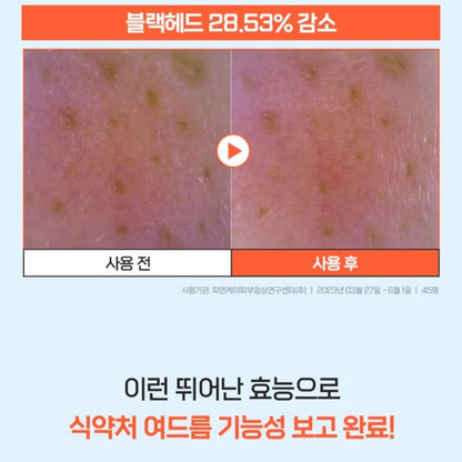 a.solution Heartleaf+Calamine Calming Cream 1.69 oz.+Cleansing Foam 5 oz./Acne