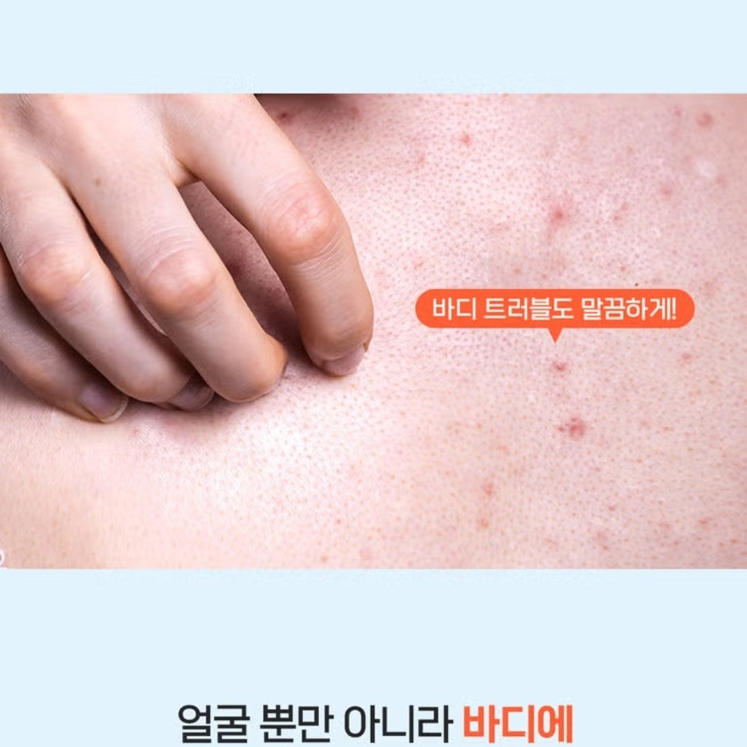 a.solution Heartleaf+Calamine Calming Cream 1.69 oz.+Cleansing Foam 5 oz./Acne