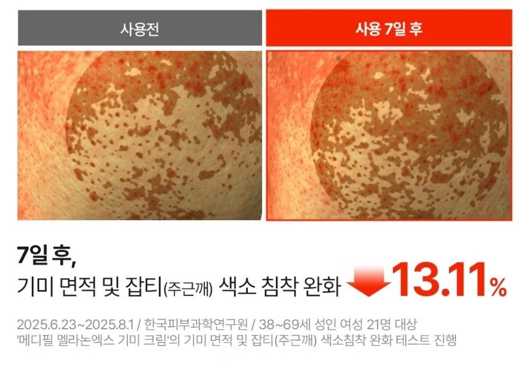 2EA/Medipeel Melanon X Freckle Cream 30ml/Brightening/Wrinkle/Skin Tone/melanin