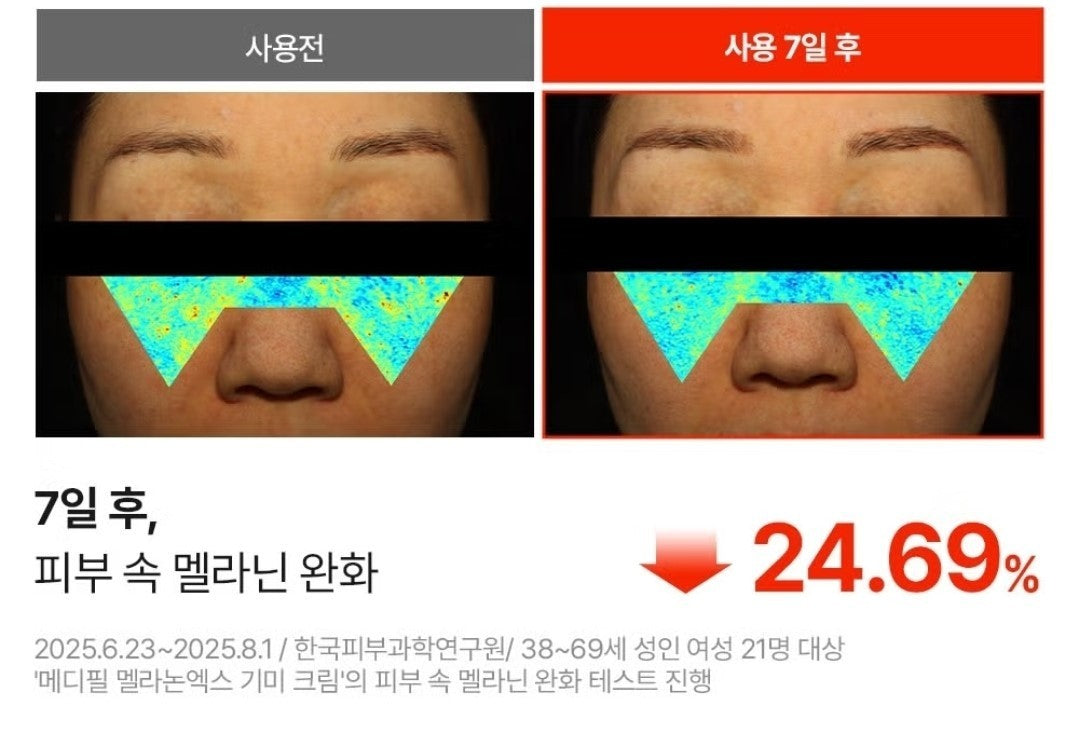 2EA/Medipeel Melanon X Freckle Cream 30ml/Brightening/Wrinkle/Skin Tone/melanin