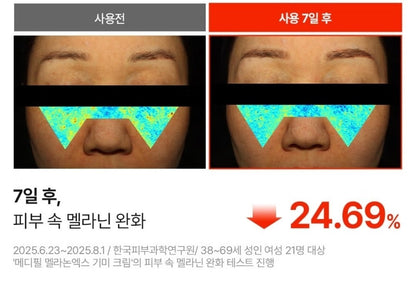 2EA/Medipeel Melanon X Freckle Cream 30ml/Brightening/Wrinkle/Skin Tone/melanin