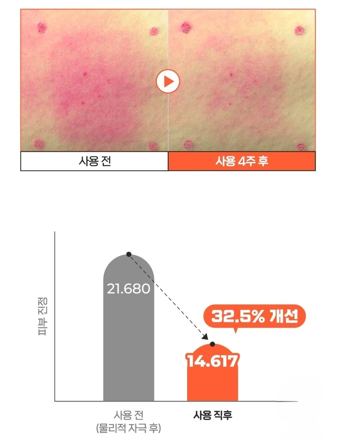 1+1/a.solution Heartleaf Trouble Toner 5.07 fl.oz./Sebum/Acne/Red Skin/Sensitive