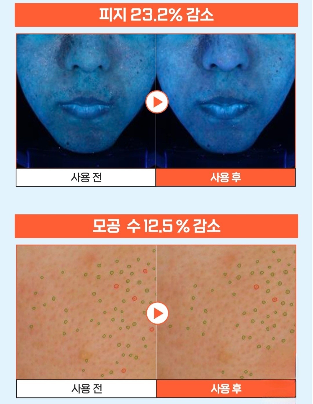 1+1/a.solution Heartleaf Trouble Toner 5.07 fl.oz./Sebum/Acne/Red Skin/Sensitive