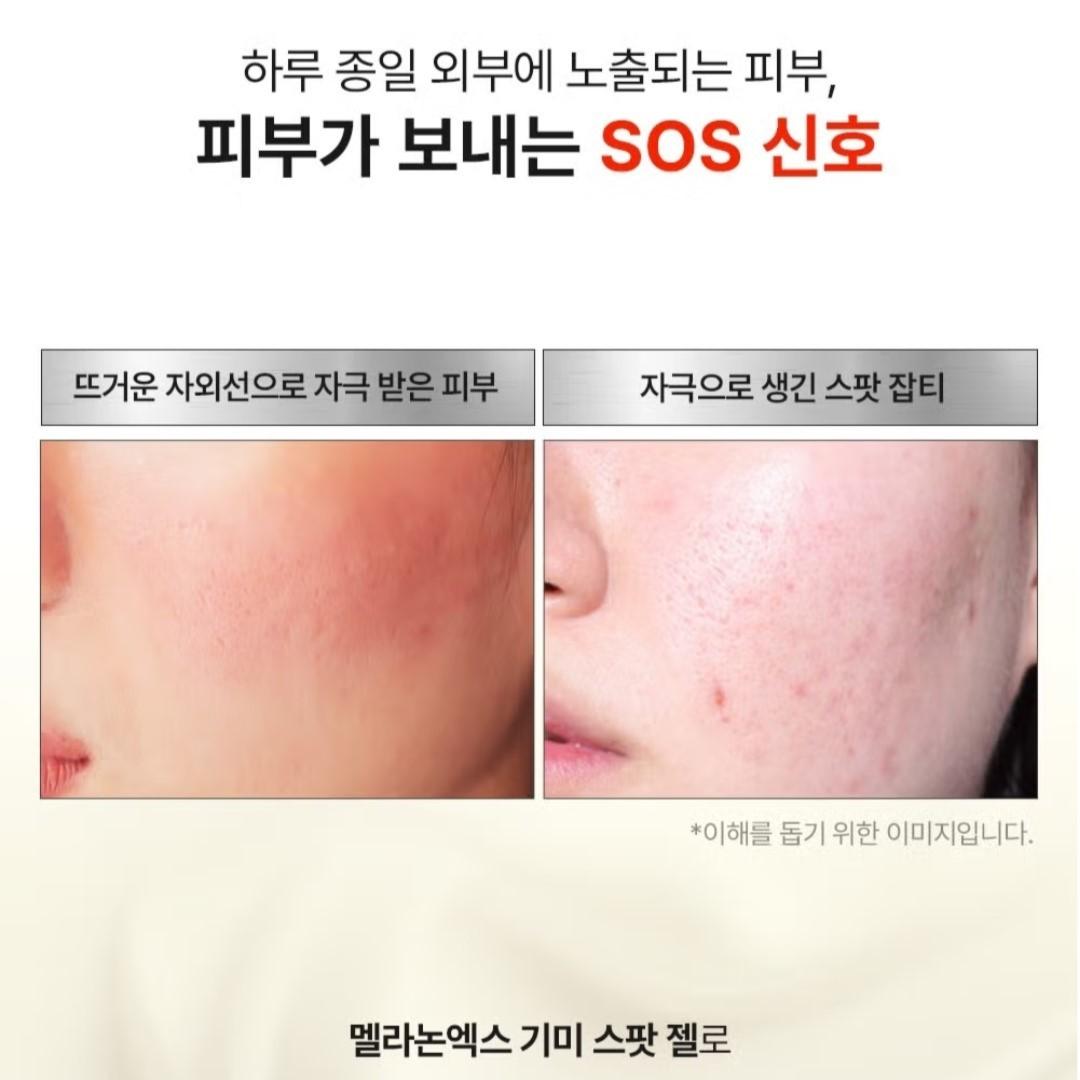 Medipeel Melanon X Freckle  Spot Gel 15ml/Brightening/Wrinkle/Skin Tone/melanin