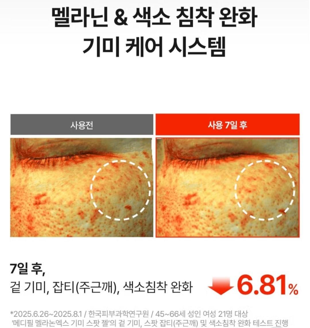 Medipeel Melanon X Freckle  Spot Gel 15ml/Brightening/Wrinkle/Skin Tone/melanin