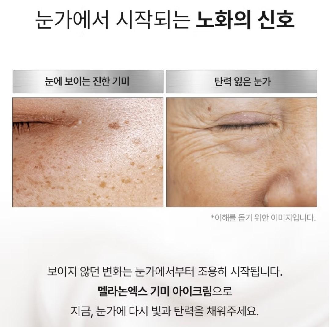 Medipeel Melanon X Freckle  Spot Gel 15ml+Eye Cream 20ml/Skin Tone/melanin