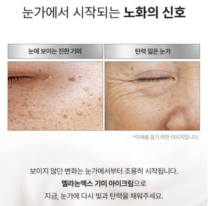Medipeel Melanon X Freckle  Spot Gel 15ml+Eye Cream 20ml/Skin Tone/melanin