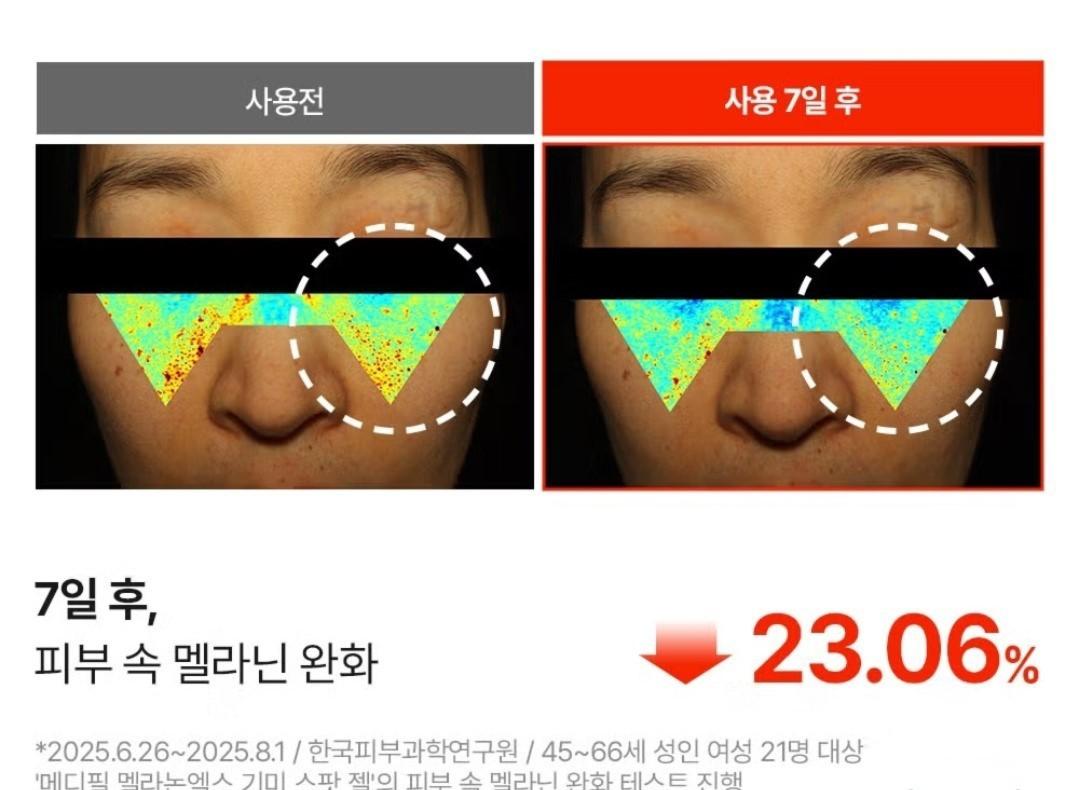 Medipeel Melanon X Freckle  Spot Gel 15ml+Eye Cream 20ml/Skin Tone/melanin