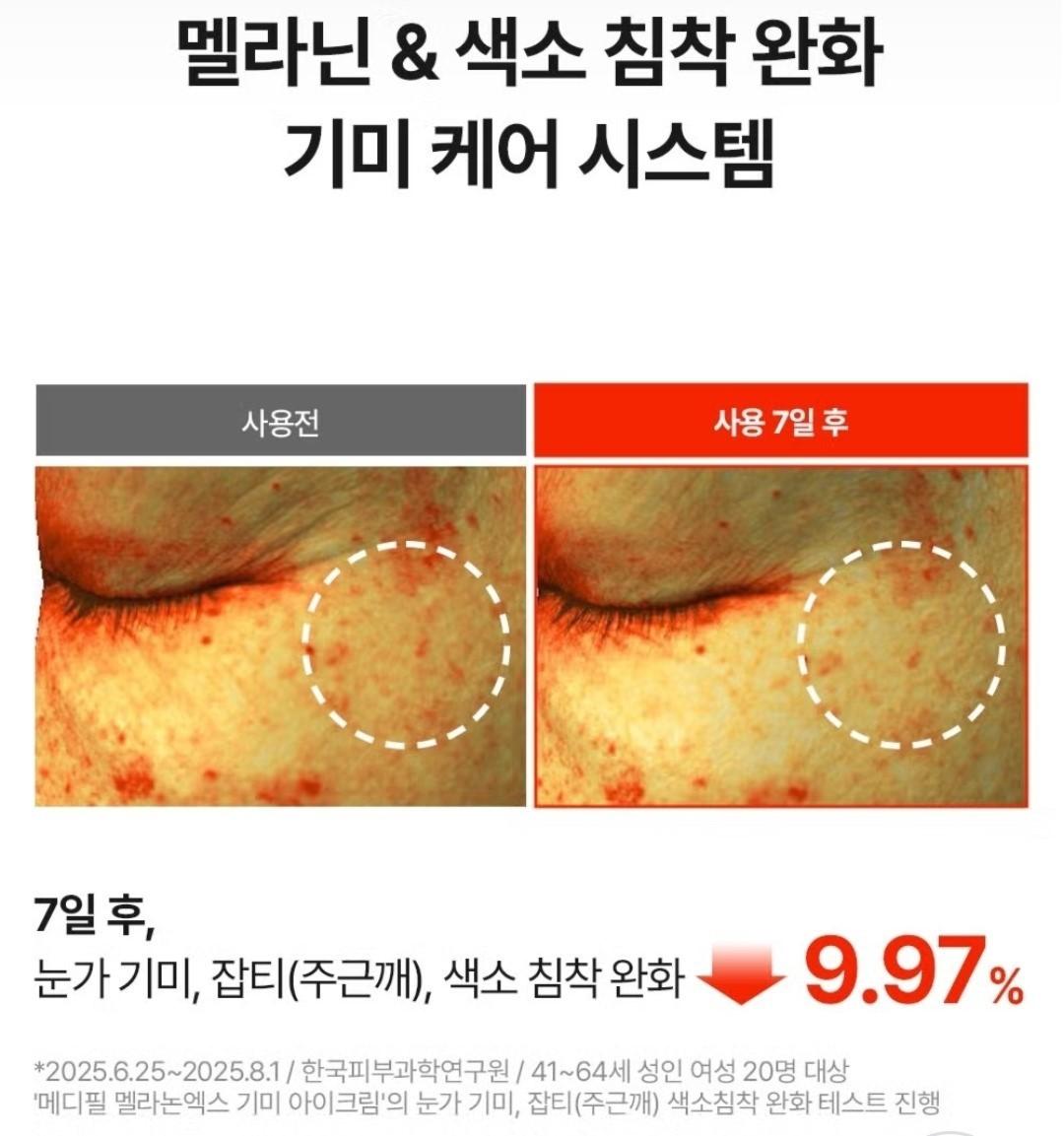 Medipeel Melanon X Freckle  Spot Gel 15ml+Eye Cream 20ml/Skin Tone/melanin