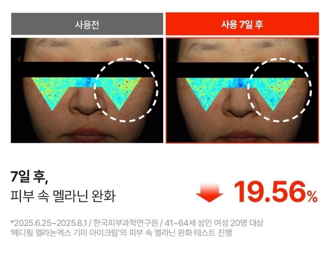 Medipeel Melanon X Freckle  Spot Gel 15ml+Eye Cream 20ml/Skin Tone/melanin