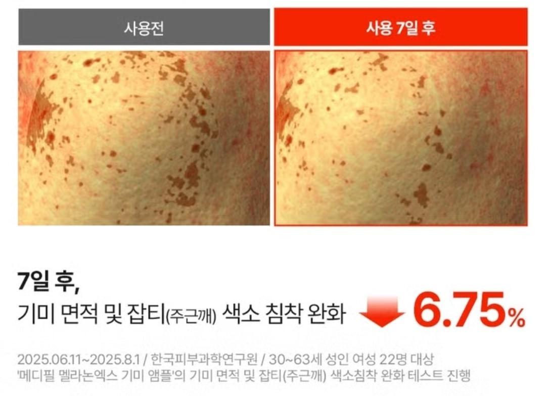 Medipeel Melanon X Freckle  Ampoule 30ml/Brightening/Wrinkle/Skin Tone/melanin