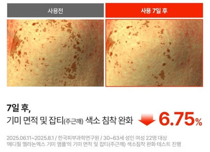 Medipeel Melanon X Freckle  Ampoule 30ml/Brightening/Wrinkle/Skin Tone/melanin