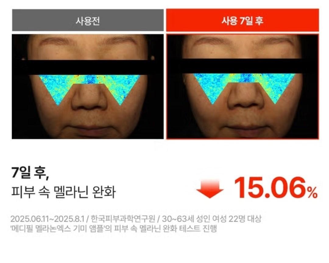 Medipeel Melanon X Freckle  Ampoule 30ml/Brightening/Wrinkle/Skin Tone/melanin