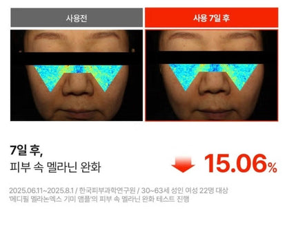 Medipeel Melanon X Freckle  Ampoule 30ml/Brightening/Wrinkle/Skin Tone/melanin