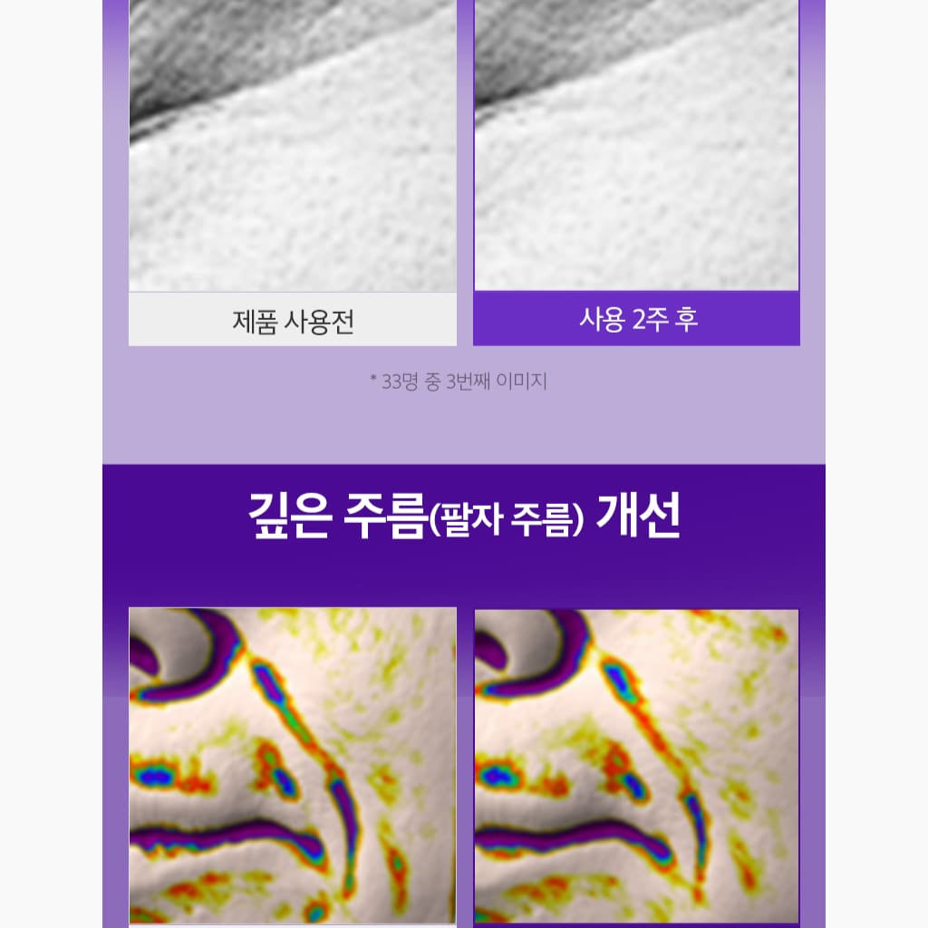 OHUI Age Recovery Essence 50ml+Refill+Kits Set/Anti-aging/Collagen/Visible signs