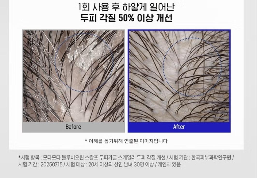 MODAMODA Blue Biotin Scalp Gagle Scaler 90ml-3 fl.oz.-Hair Loss-Antibacteria