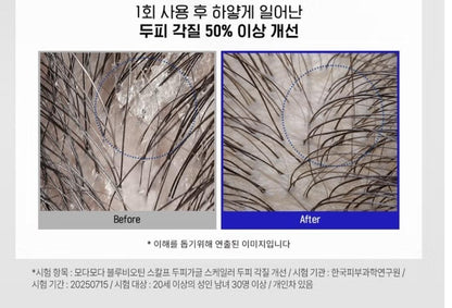 MODAMODA Blue Biotin Scalp Gagle Scaler 90ml-3 fl.oz.-Hair Loss-Antibacteria