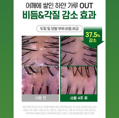 Shampooing TS Dandruff Care-Démangeaisons du cuir chevelu-Matériau...