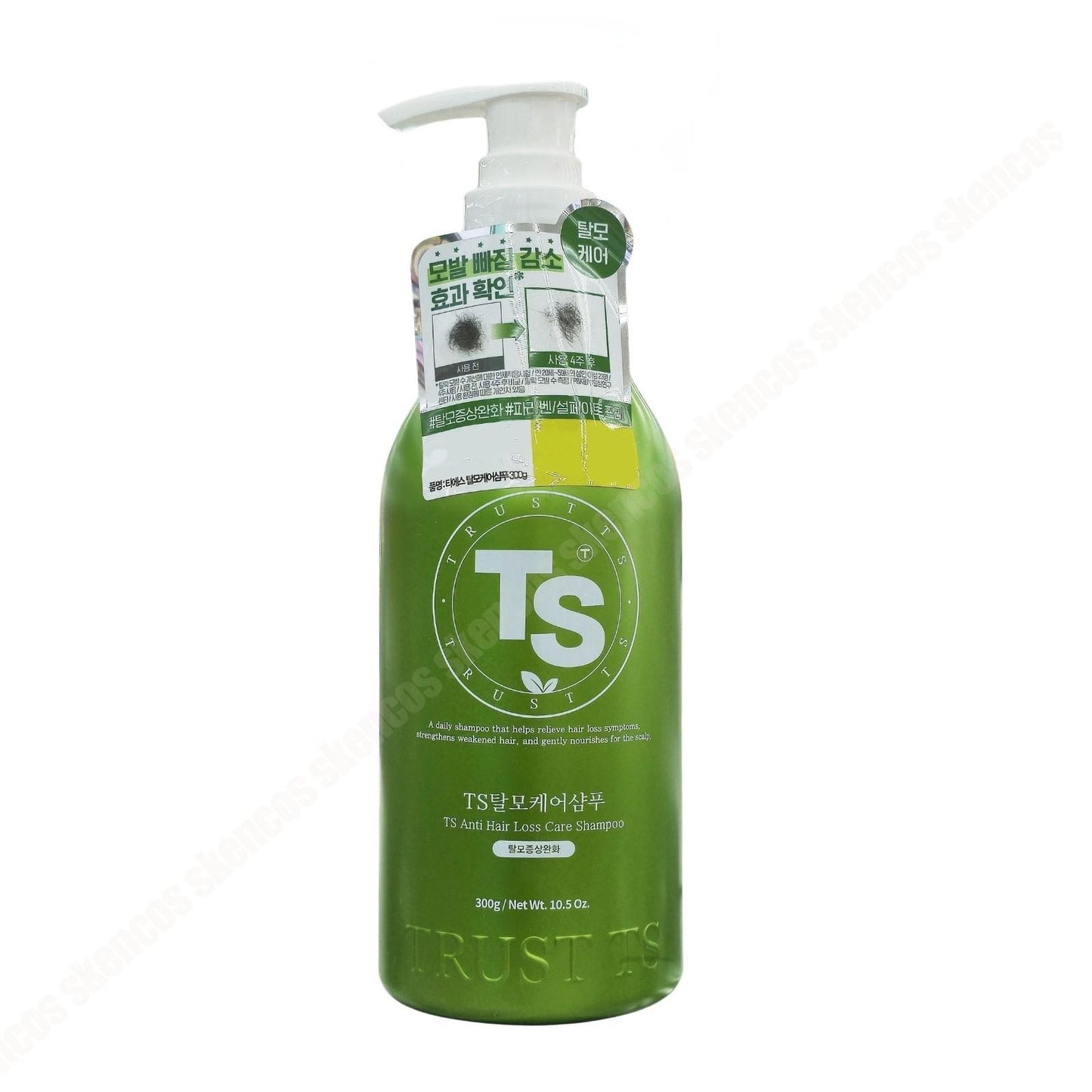 TS Anti-Hair Loss Shampoo-Scalp itchiness-Korean material-11 Free-Floral Musk