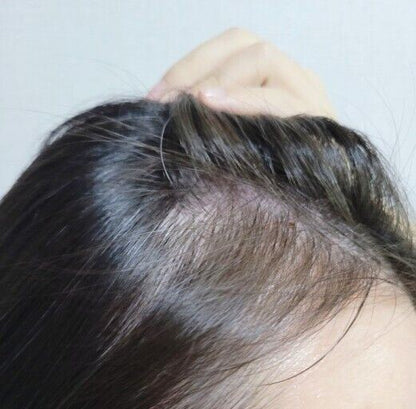 SOME BY MI Cica Peptide Anti Hair Loss Derma Scalp Shampoo285ml+Treatment 50ml