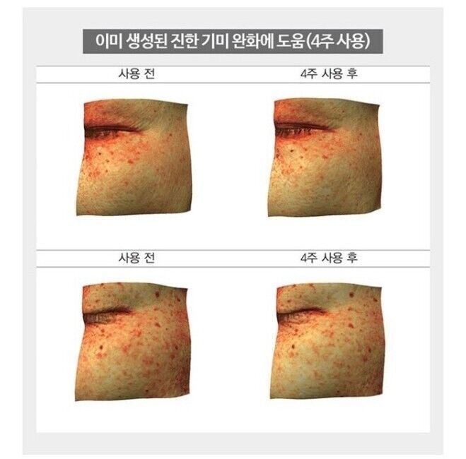 Cheongchun Cosmetics Intensive Freckle Cream 7 oz+O HUI/OHUI-Sunscreen SPF50