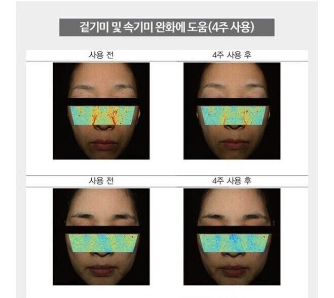 Cheongchun Cosmetics Интенсивный крем от веснушек 7 унций+O HUI/OHUI-Солнцезащитный крем SPF50 