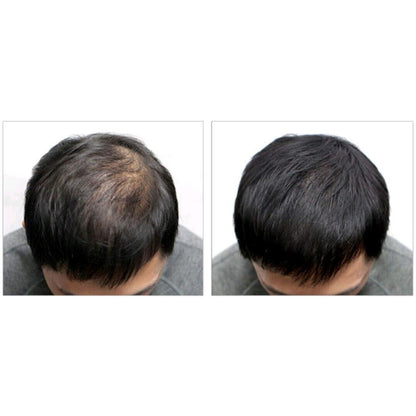 DASHU Tägliches Anti-Haarausfall-Haarkissen, 26 g, natürliches Schwarz, wasserfest, leicht zu waschen